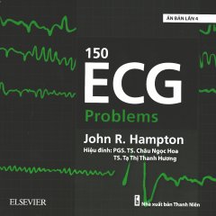 150 ECG Problems